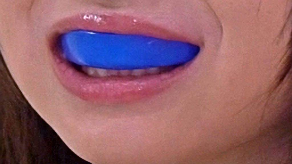 Mouthguard.jpg